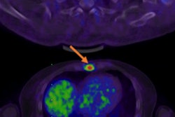 2017 02 01 11 37 20 278 Bbn Rgd Pet Jnm Chen 400