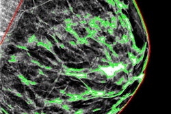2017 02 02 12 14 28 595 2017 02 03 Density Segmentation Thumb