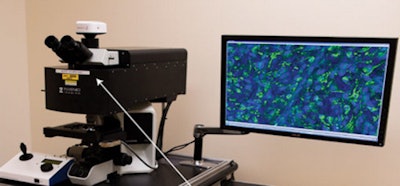 A stimulated Raman scattering (SRS) microscope helps neurosurgeons analyze tissue without the need for tissue processing, speeding up the decision-making process during brain tumor surgery. Image courtesy of NIBIB.