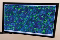 2017 02 10 17 06 58 13 Microscopy 300