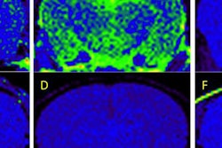 2017 02 14 15 32 27 264 Alzeca Cropped 20170214223305