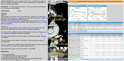 Example of a multimedia radiology report for three metastatic (urothelial cancer) target lesions that have been followed over a year and show partial treatment response in accordance with RECIST 1.1 criteria. The graphs depict tumor shrinkage over time; the left graph includes all three tumors, while the right graph shows three individual target lesions. Image courtesy of Dr. Les Folio.