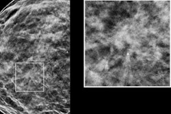 2017 02 17 15 50 10 522 Synthesized 2 D Dbt 20170217225124