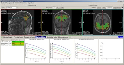 The fully automated segmentation and quantification of different brain regions based on a machine learning algorithm. Software enables the identification of patients at risk of developing dementia long before symptoms of cognitive impairment are apparent. Images courtesy of Dr. Gabriel Krestin, PhD. Originally published in ECR Today 2017.