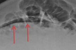 2017 03 04 14 05 11 6 2017 03 05 Er Errors Thumb