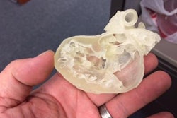 2017 03 14 15 20 36 369 Stratasys Pediatric Heart 20170314222050