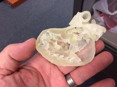 3D-printed pediatric heart. Image courtesy of Business Wire.