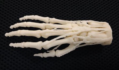 3D-printed hand model for teaching, diagnosis, and procedural planning. Image courtesy of Business Wire.
