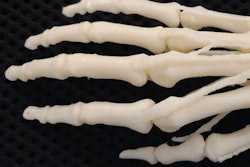 2017 03 17 11 26 17 436 Stratasys Printed Hand 20170317182733