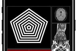 2017 03 20 15 55 38 447 Kspace2 400