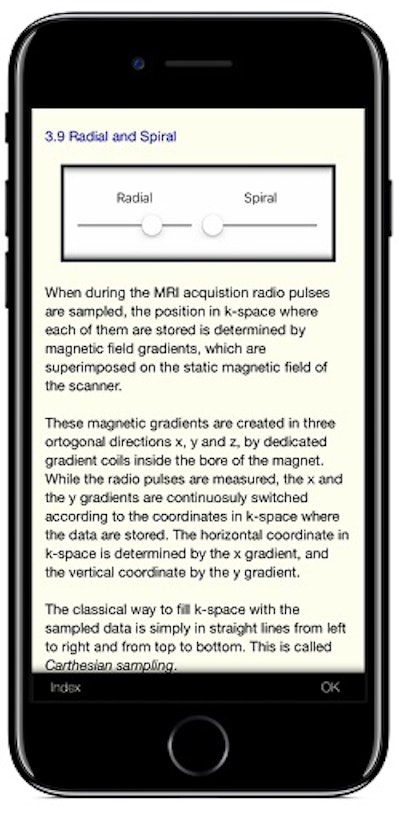 The app can perform radial and spiral reconstruction of a beating heart in real-time.