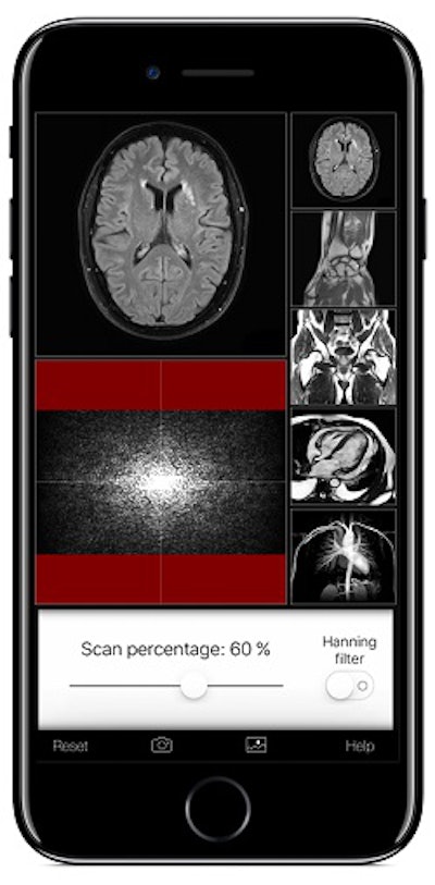 A k-Space Odyssey allows users to change MRI scan parameters such as scan percentage and see the effect on the MR image. All images courtesy of Eltjo Haselhoff, PhD.