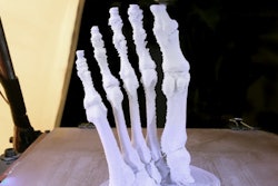 2017 03 21 15 32 11 587 3 D Printing Hand 400