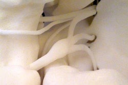 2017 03 22 10 52 10 186 Cranial Nerve 2 20170322175253