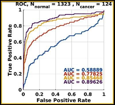 Progressive machine learning also improved the software's accuracy for breast masses, as demonstrated by increasingly higher areas under the ROC curve after training.