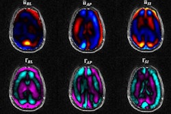 2017 04 05 10 09 45 60 Mre Tbi Bayly 20170405171028