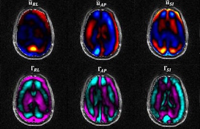 Images show displacement of brain tissue (top row) and changes in shape (bottom row). Courtesy of Bayly Lab and Washington University in St. Louis.