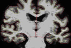 2017 04 05 10 49 12 140 Superager Brain 20170405174926