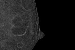 2017 04 11 14 37 23 155 Mlo Cedm 1 20170411213911