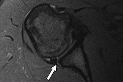 2017 04 18 16 49 40 756 Labral Standard Mri 03b 20170418235028