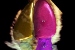 2017 05 01 10 35 22 233 Philips Heart Model 20170501173721