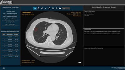 Infervision has developed a deep-learning model that can be used to identify lung nodules on chest CT studies. Image courtesy of Infervision.
