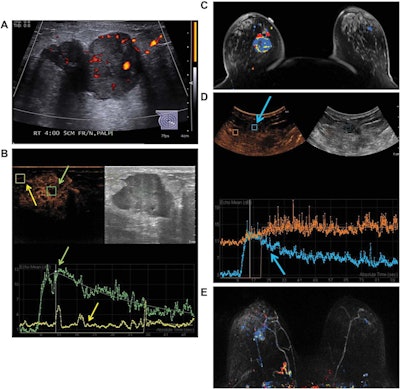 2017 05 15 14 41 08 931 Lee Ceus Breast Jum 800
