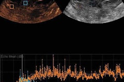 2017 05 15 14 41 09 694 Lee Ceus Breast Jum 20170515215332