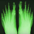 2017 05 18 16 11 54 198 Shoe Fluoroscope 400