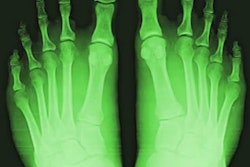 2017 05 18 16 11 54 198 Shoe Fluoroscope 400