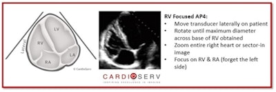 RV focused AP4 view