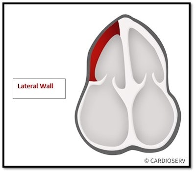 Apical four-chamber view