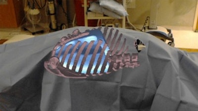 In this proof of concept, a CT scan of a phantom was used to create a hologram. Once registered using a paper clip as a fiducial marker, the hologram could be viewed on Microsoft HoloLens during image-guided procedures. Image courtesy of Dr. Vikash Gupta.