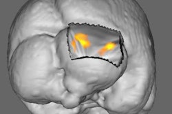 2017 05 31 16 52 36 699 Plos One F Mri 20170531235259