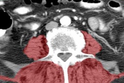 2017 06 02 14 05 28 118 Ct Core Muscle 20170602210604