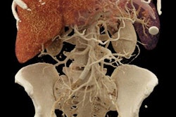 2017 06 05 16 36 31 297 Fishman Cinematic Rendering 20170605233708