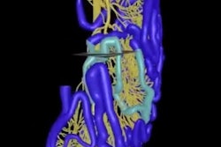 2017 06 06 17 09 44 291 2017 06 07 Small Bowel Mapping Summers 400