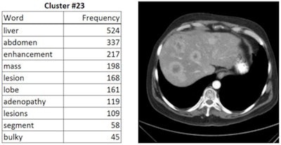 Automated labeling of CT images using deep learning. The image on the right was determined to fall into a similar cluster of images having the labels listed in the table on the left. Lead developers in NIH group: Xiaosong Wang and Le Lu.