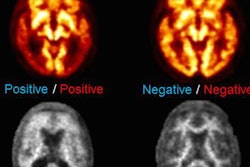 2017 06 09 16 42 42 144 Barthel Figure 20170609234309