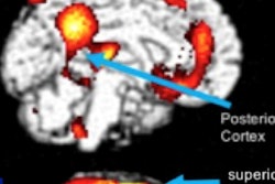 2017 06 13 10 10 42 577 Silverman Nfl 400 Thumb