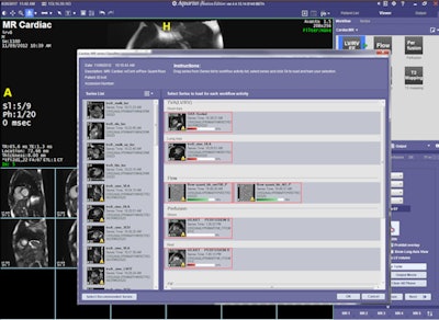 Image Organizer demonstrates image classification in a cardiac MR exam showing match confidence.
