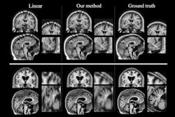 2017 06 22 09 51 54 495 Mri Stroke Images 500
