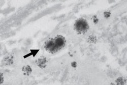 2017 06 26 15 29 59 970 2017 06 27 Gadolinium Contrast 20170626223648