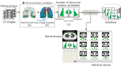 Fujitsu's AI-based technology is designed to find previous CT studies that represent similar disease cases. Image courtesy of Fujitsu.