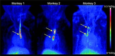 PET images of three monkeys show strong signals detected at the sites where inserted catheters had roughened surfaces. Almost no other background signal is visible. Only accumulation in the gallbladder becomes visible at the bottom of the image. Images courtesy of Piramal Imaging and JNM.