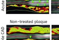 2017 07 12 16 08 09 525 Ct Plaques 20170712231003