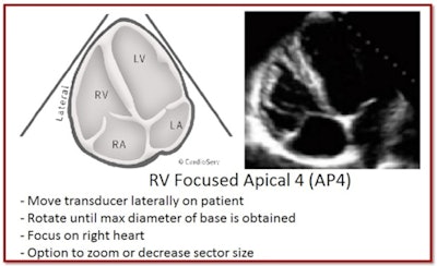 All images courtesy of CardioServ.