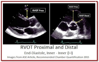 RVOT Proximal and Distal