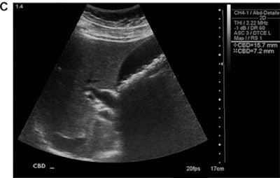 2017 07 24 11 45 52 951 Poc Us Jum C 450