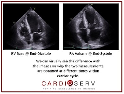 End-Diastole vs. End-Systole